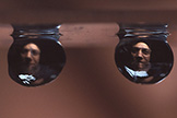 Cataracts 
